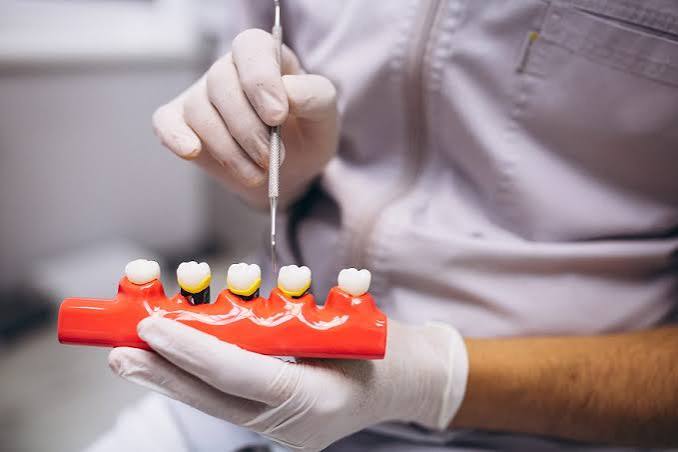 Dental Crown or Filling in Greensborough: How Is the Decision Made?