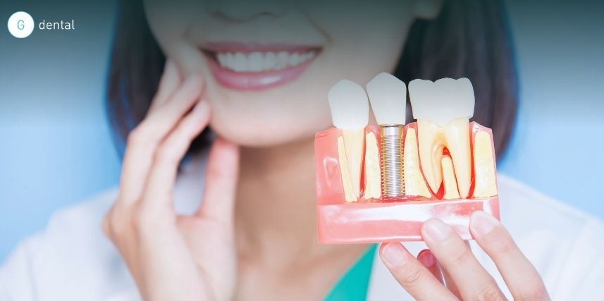 Loose Dental Implant: Is It the Crown, Connector or Implant?